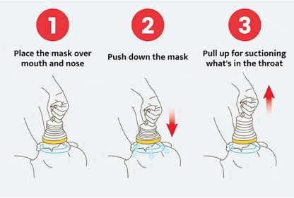 Choking Rescue Device - Anti-Choking Device